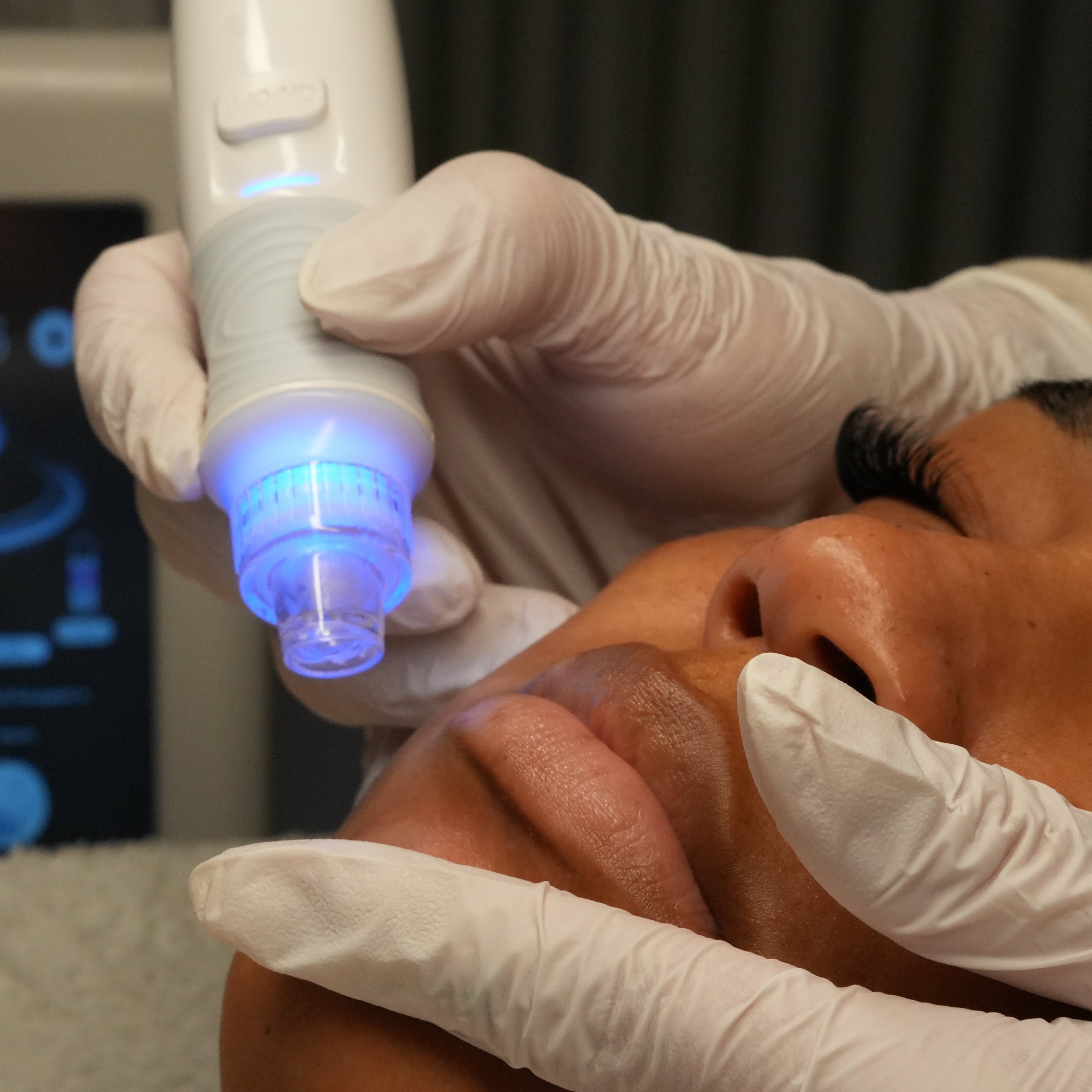 Aquaneedling Schulung