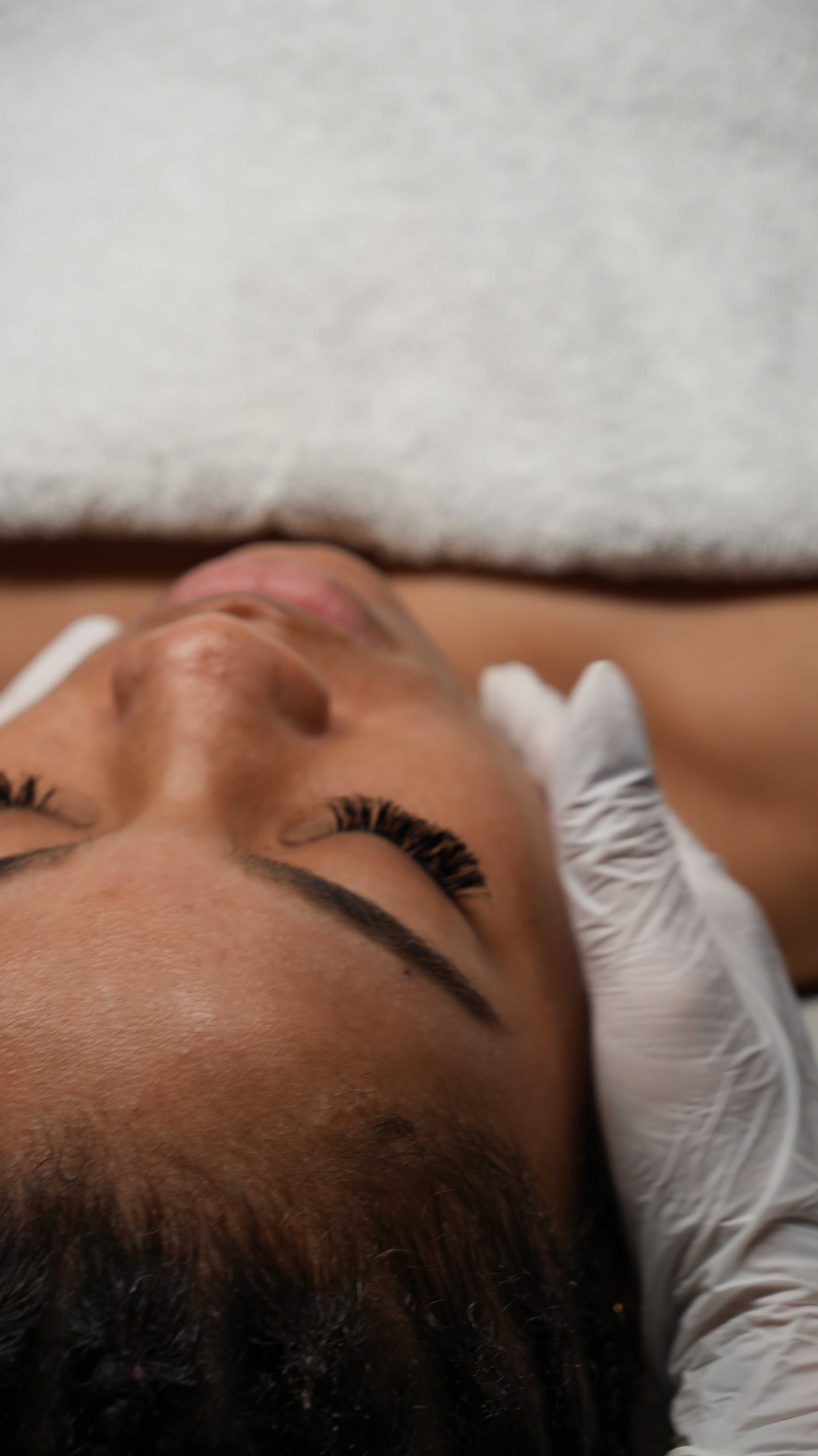 Microneedling Schulung