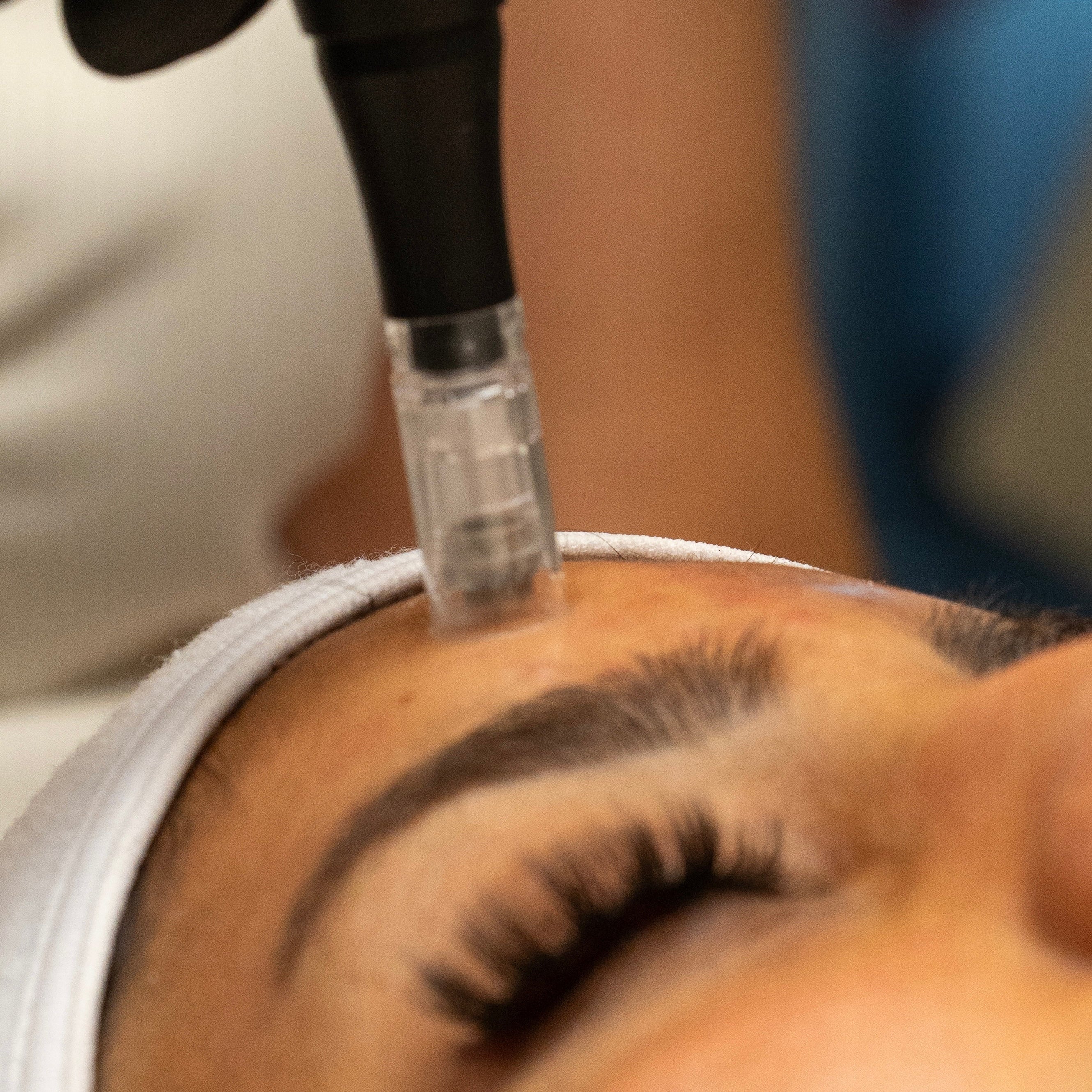 Aquaneedling Schulung